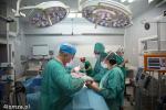 Foto: Neuromonitoring podczas operacji wola tarczycy ...