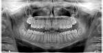 Foto: Aparat ortodontyczny - odkrywamy tajemnice, oba...